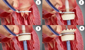 HighLife UNE HighLife UNE